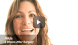 lhochsteinmd.com  Rhinoplasty Miami