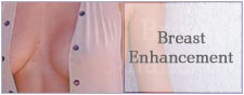 Breast Surgery