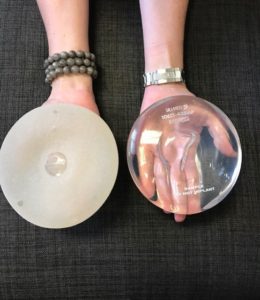 Breast implants in a person's hands