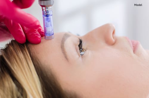 hardware cosmetology, mesotherapy, close up of young woman getting treatment of forehead zone at spa-img-blog