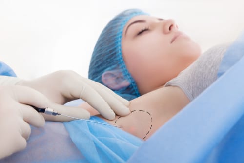 woman having anti sweat armpit mesotherapy-img-blog