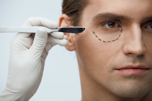 closeup of handsome male face with black marks on skin under eye-img-blog