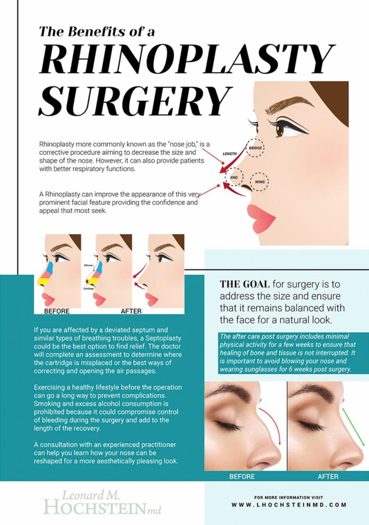 The Benefits of a Rhinoplasty Leonard Hochstein, MD