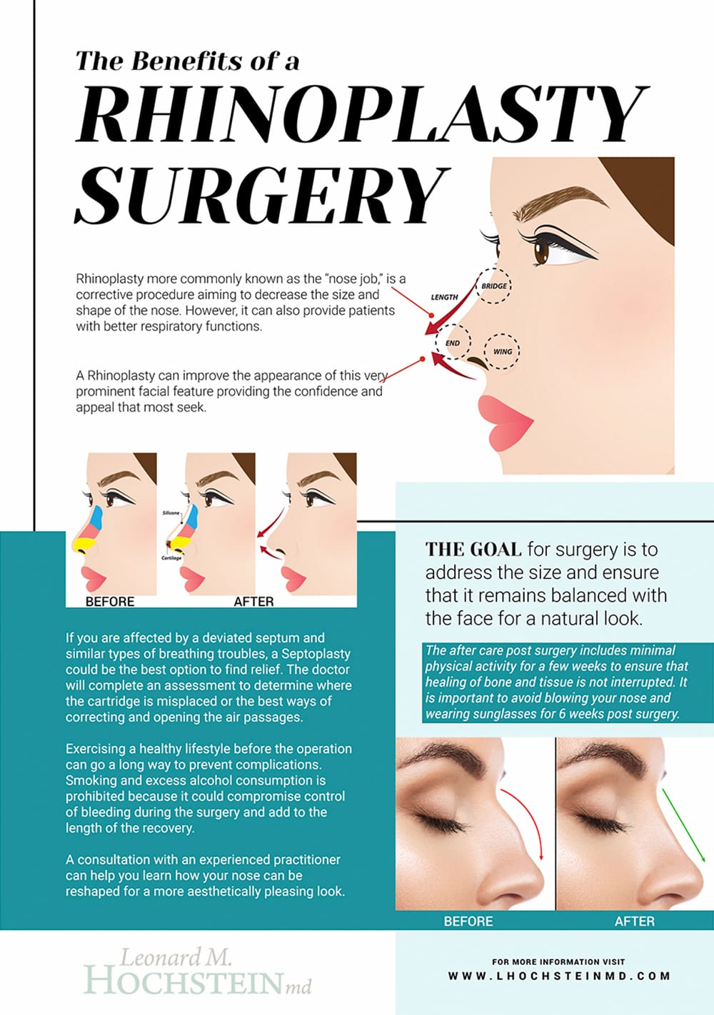 Dr. Trussler Rhinoplasty Surgery