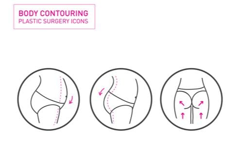 BBL Surgery - Infographic