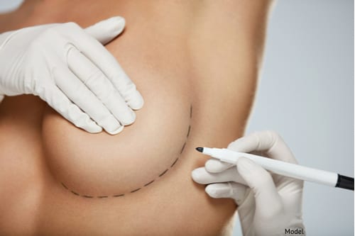 consultation for breast revision