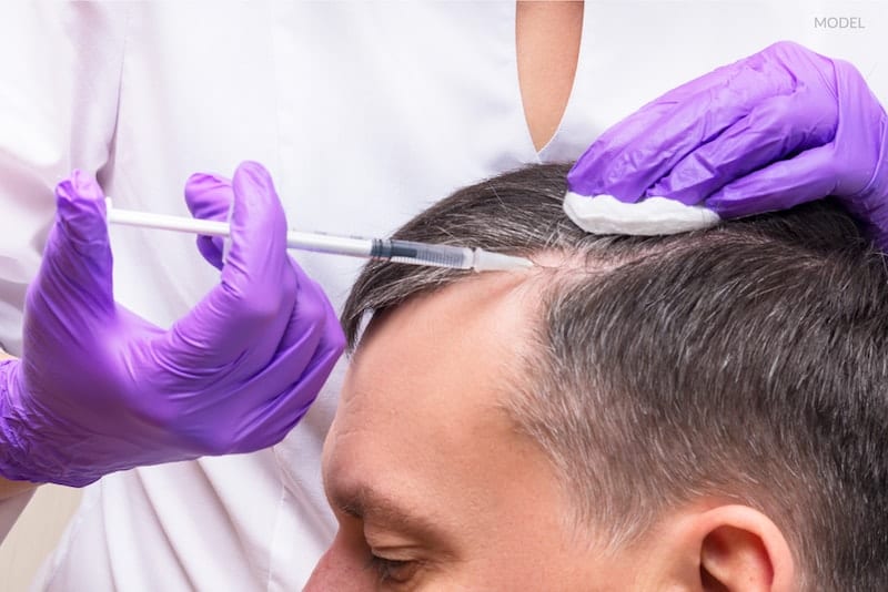 A man with a receding hair line getting a PRP injection to regenerate his hair follicles.