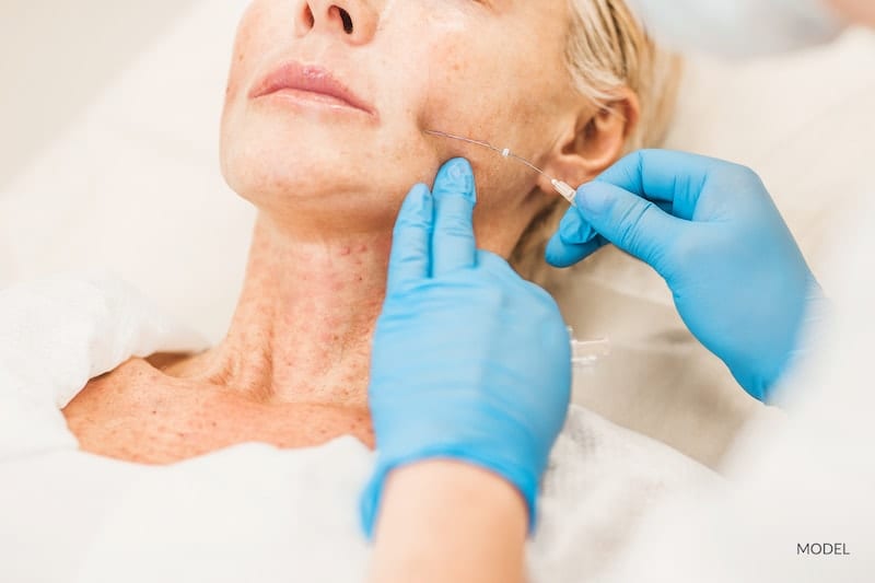 Woman undergoing a thread lift with her plastic surgeon.