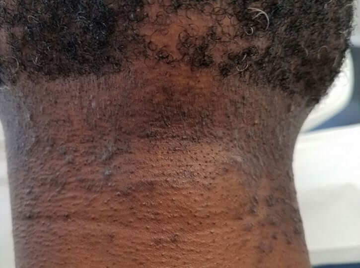 Patient Before - 3
