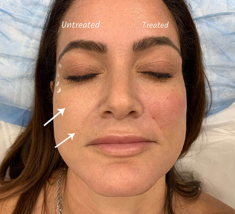  Patient Before & After - 1