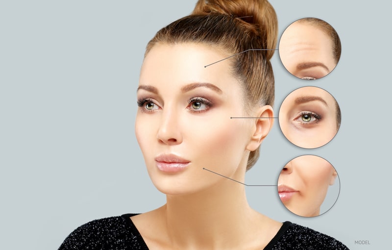 Woman's face with the forehead, eyes, and mouth zoomed in to show common locations of facial aging.