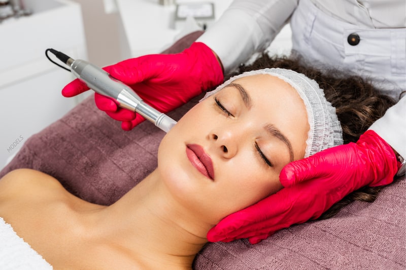 Woman undergoing a microneedling treatment.