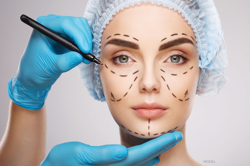 Doctor marking women's face just before a facelift.