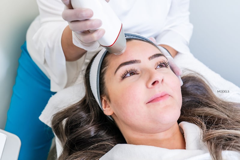 A woman receiving an RF microneedling treatment.