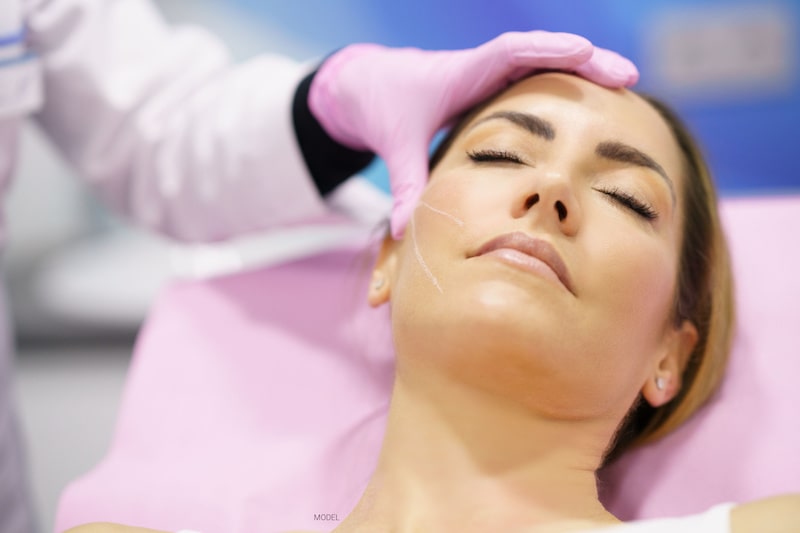 A woman is prepared to receive a PDO thread lift.