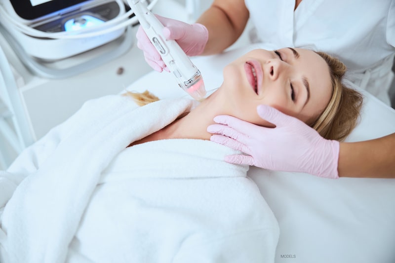 Beautiful women smiling as she has a microneedling treatment performed on her neck.