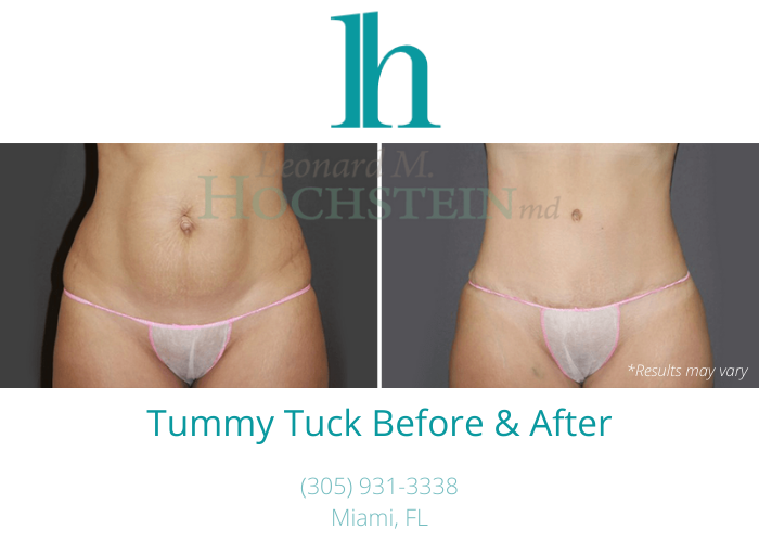 Actual before and after patient results